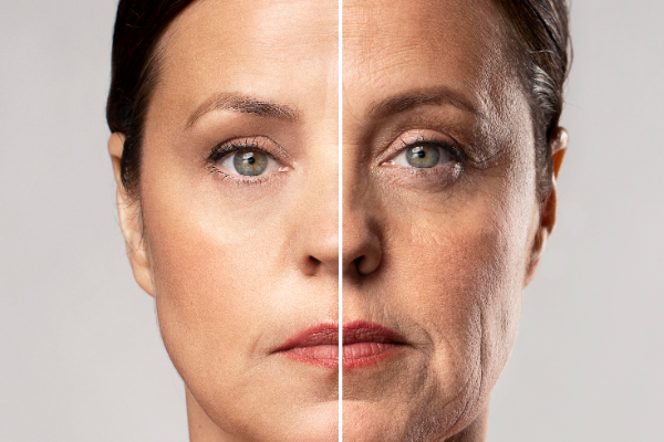 Derin Plan Yüz Germe ile Doğal ve Kalıcı Gençlik